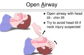 Airway open